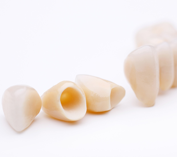 Hamilton Dental Crowns and Dental Bridges