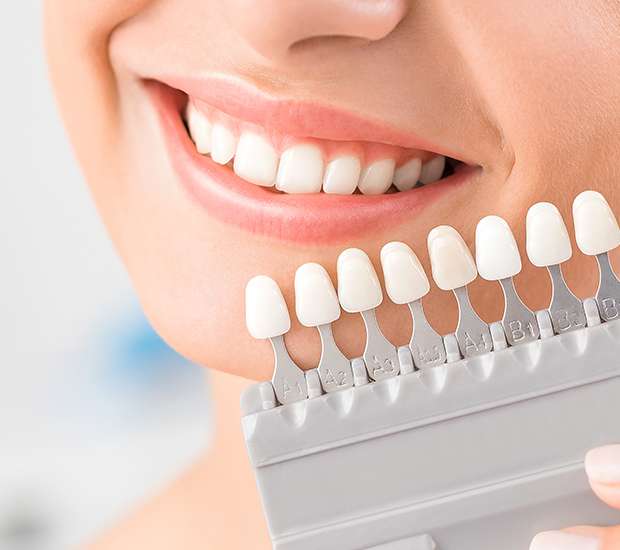 Hamilton Dental Veneers and Dental Laminates