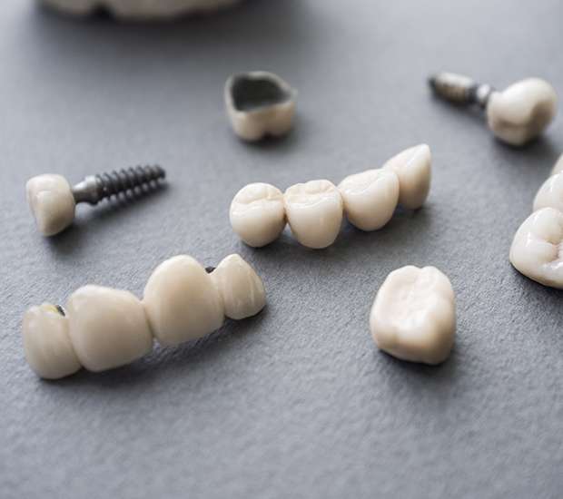 Hamilton The Difference Between Dental Implants and Mini Dental Implants