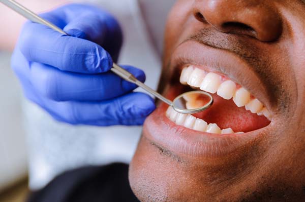 Popular Treatments Used In Cosmetic Dentistry