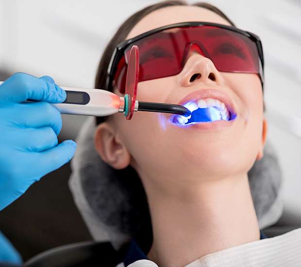 Hamilton Professional Teeth Whitening